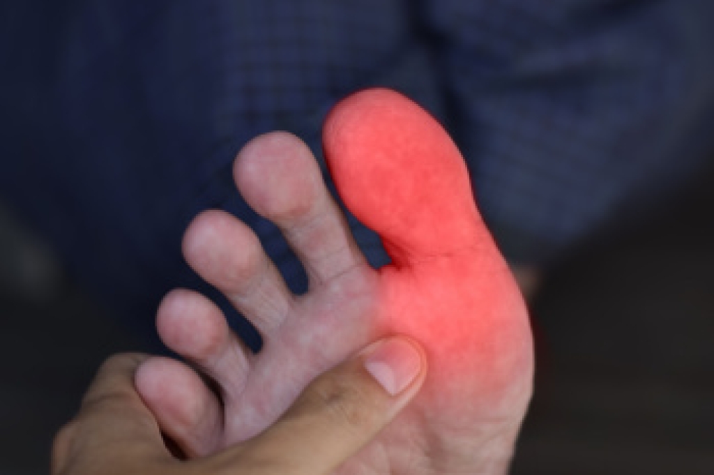 Why the Big Toe Joint Takes Time to Heal