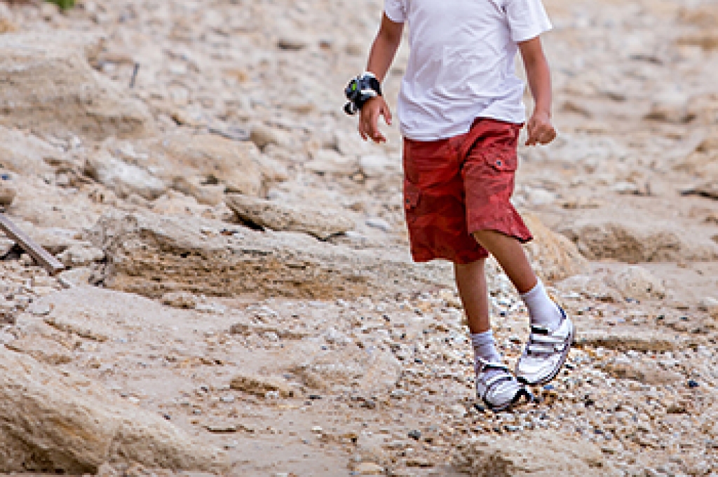Clubfoot and Early Treatment Options