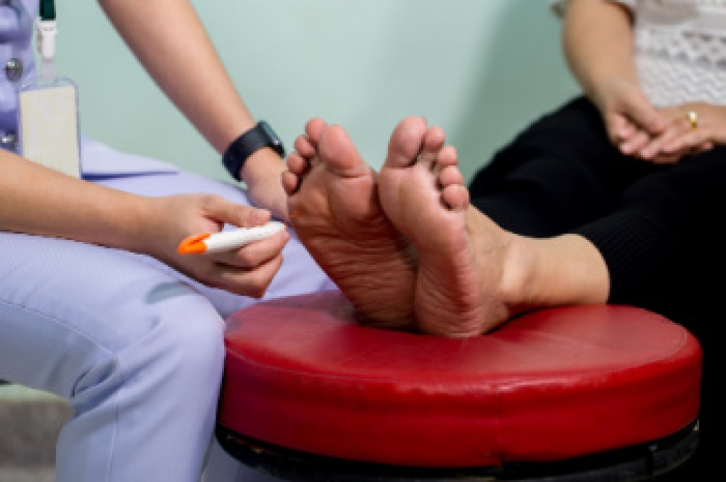 Peripheral Neuropathy and Foot Health