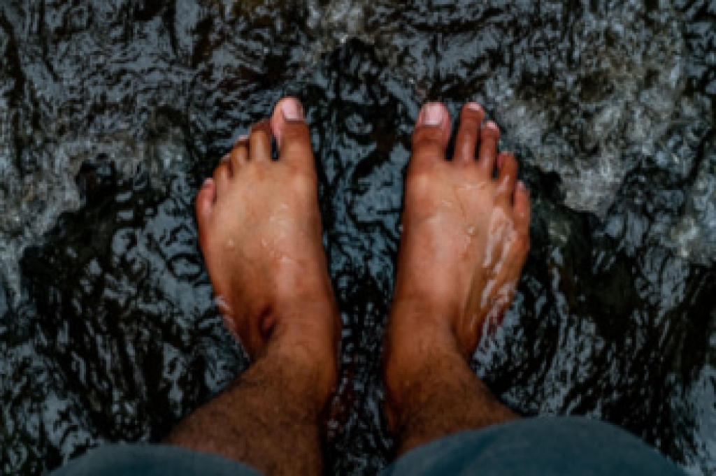 Finding Relief From Hammertoes